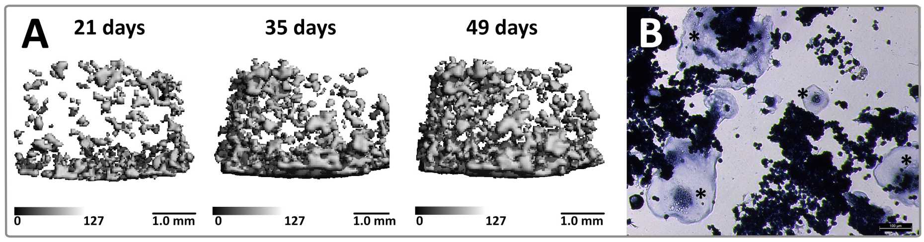Enlarged view: 3D tissue-engineered bone adaptation model