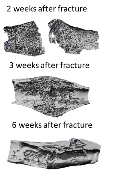 Quantitative phenotyping of bone fracture repair