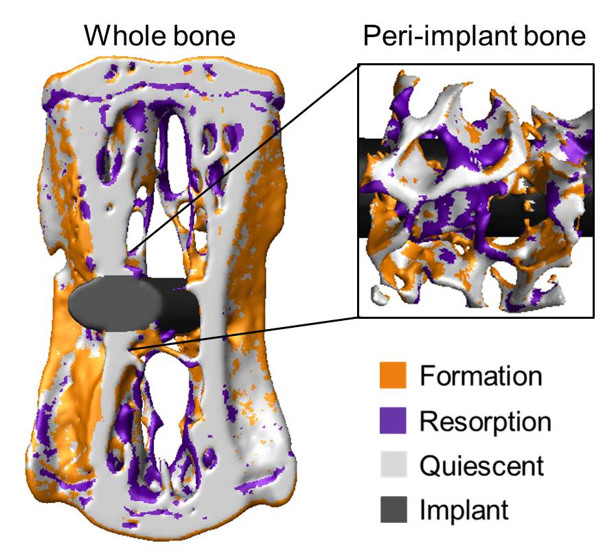 Enlarged view: Time-lapsed bone response to implantation in a mouse model of disease and treatment