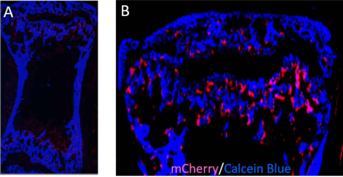 Enlarged view: Vertebra section of CRISPR/Cas9-based fluorescent reporter mouse for osteoclasts: endogenous mCherry signal (red), Calcein blue staining (blue). A. overview image; B. Growth plate and primary spongiosa. 