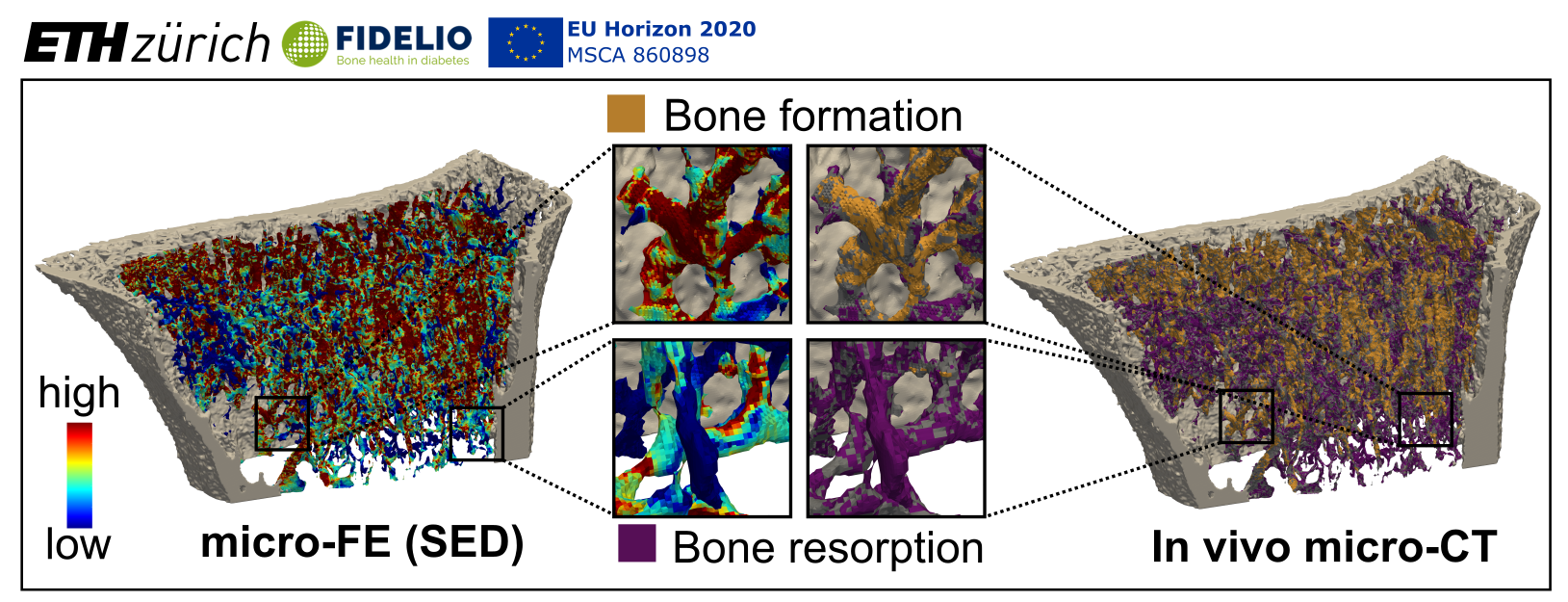Enlarged view: figure of micro-FE and in vivo micro CT scans