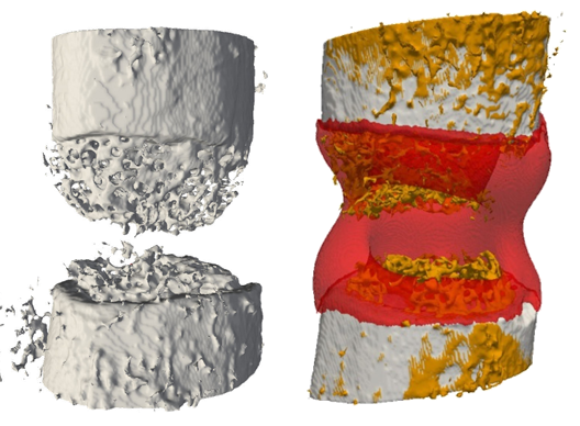 Enlarged view: In sillico multi-scale model of natural and augmented fracture healing