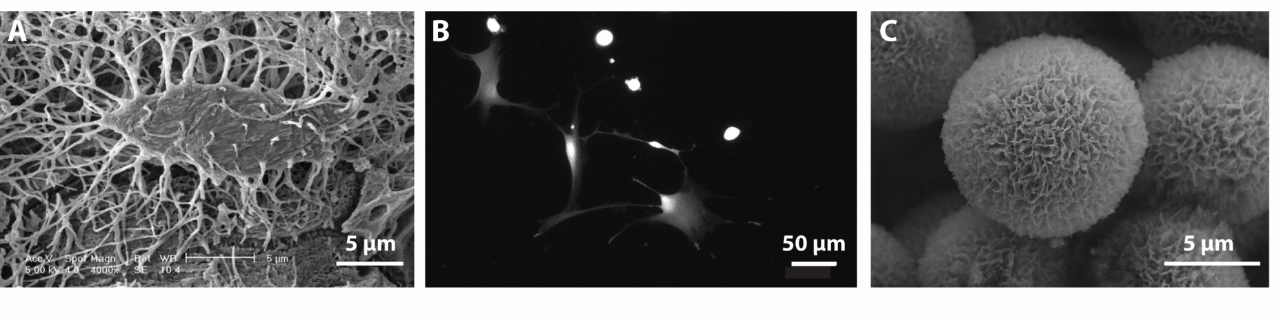 Towards biomimetic 3D osteocyte cultures