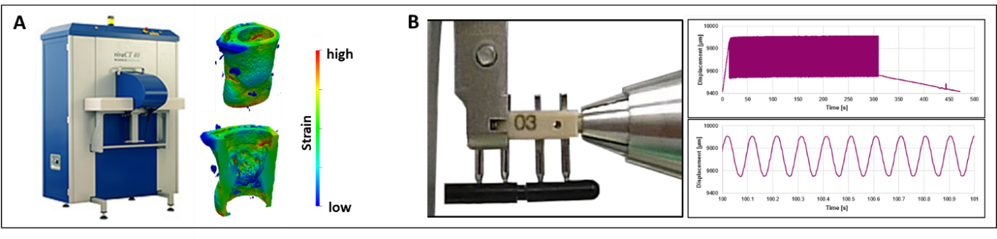 Enlarged view: Mechano-Molecular Regulation of Fracture Healing