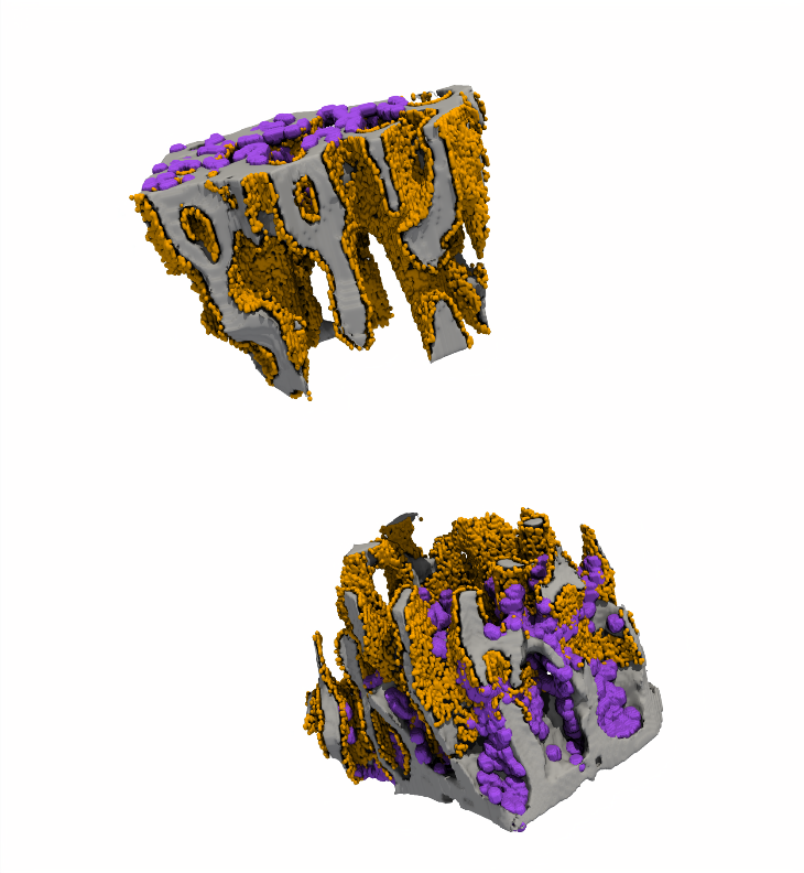 Enlarged view: Figure 1: Trabecular component of the murine vertebra with osteoclasts (purple) and osteoblasts (orange).