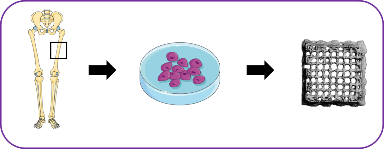 Enlarged view: 3D Bioprinting of Bone Organoids 